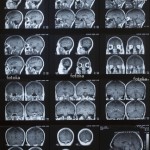 mri4