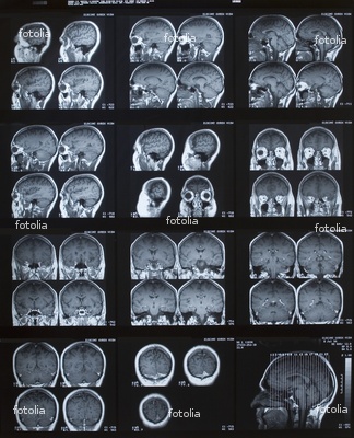 mri4